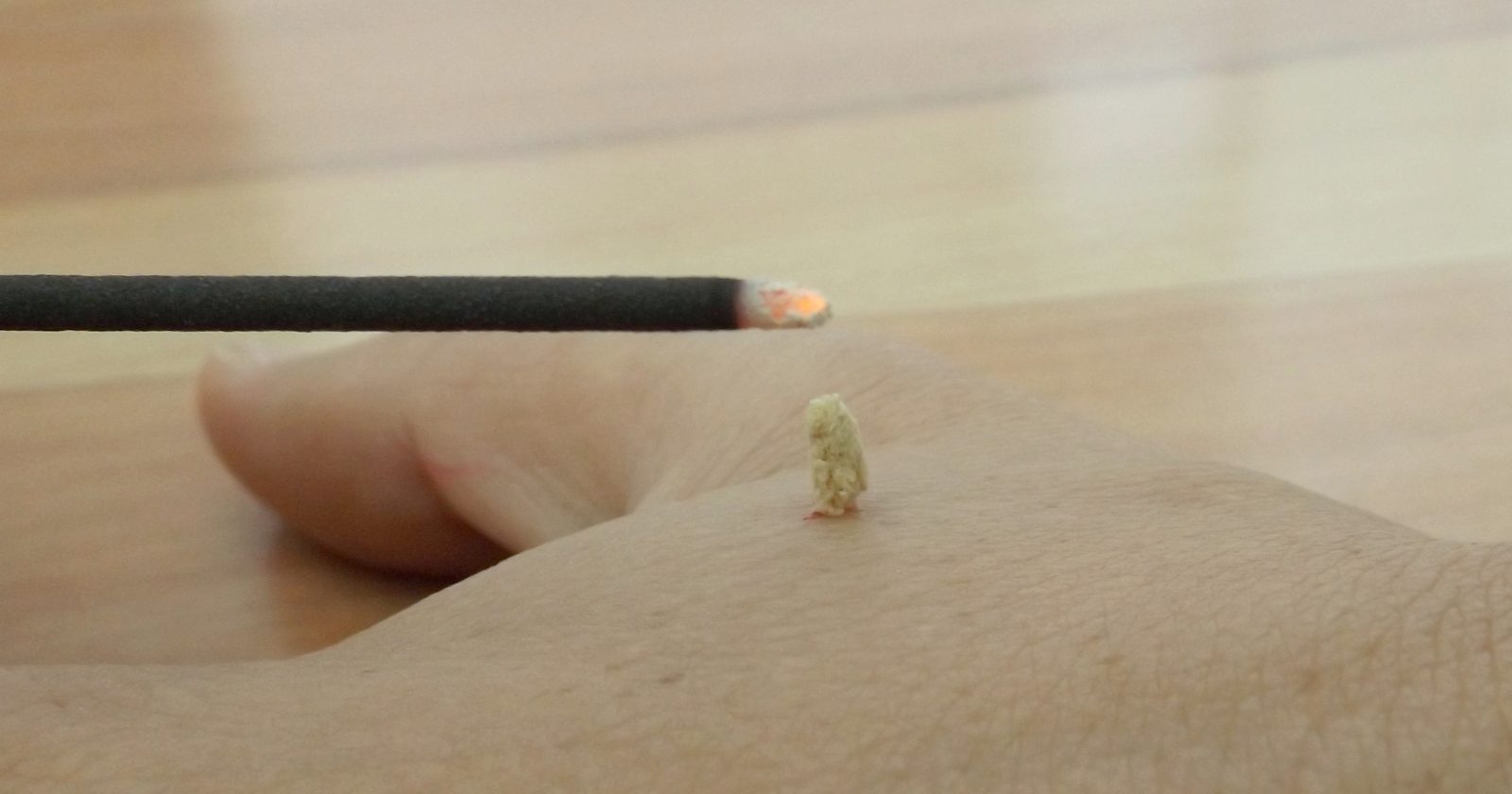 A lit moxa stick held beside a small cone of moxa resting on the hand